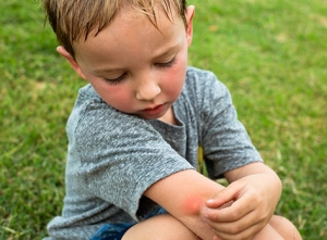 little boy with red rash on his elbow