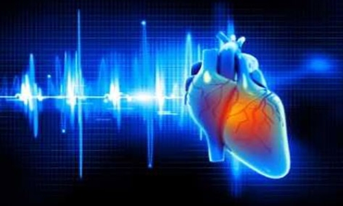Image if a heart superimposed on an EKG. electrophysiologist
